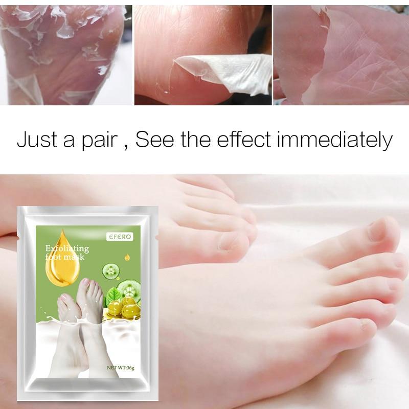 Aloe Vera Foot Mask for Exfoliating & Softening | Peeling Scrub for Dry, Cracked Heels | 1 Pair