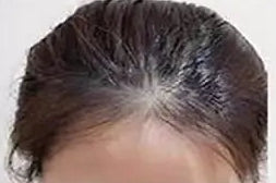 6mm Toupee Hairpiece – High-Quality Natural Hair for Seamless Style & Coverage