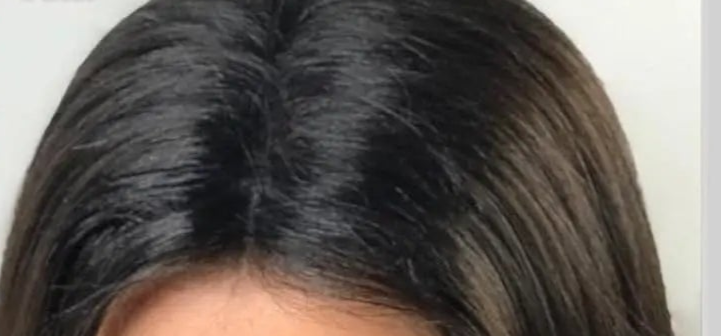 6mm Toupee for Men – Natural Hair Texture | 6-Month Durable Hairpiece