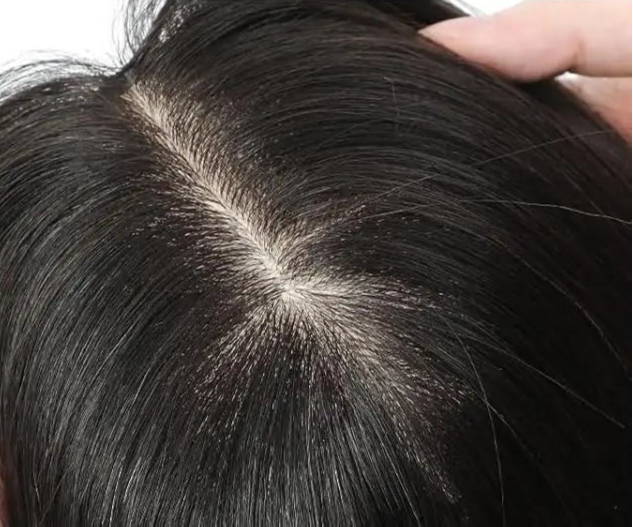 6mm Toupee for Men – Natural Hair Texture | 6-Month Durable Hairpiece