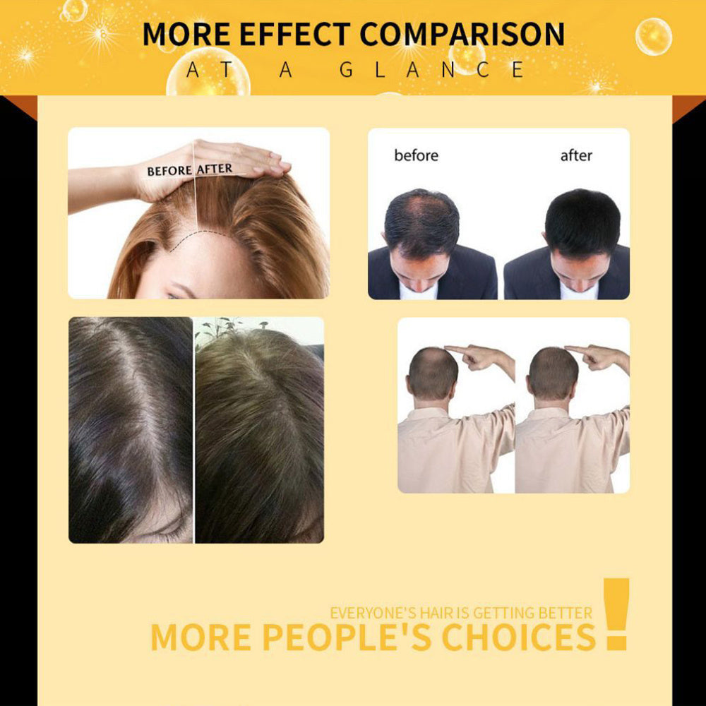 Advanced Hair Growth Essence Oil - Rapid Repair & Anti-Hair Loss Formula