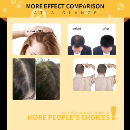 Advanced Hair Growth Essence Oil - Rapid Repair & Anti-Hair Loss Formula