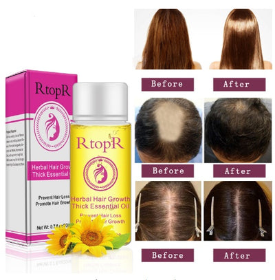 Rapid Growth Hair Essence Oil 20ml - Prevent Hair Loss & Boost Thickness