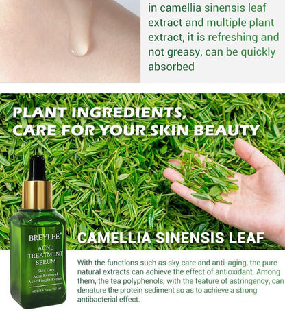 Advanced Acne Repair Serum with Camellia Sinensis & Plant Extracts