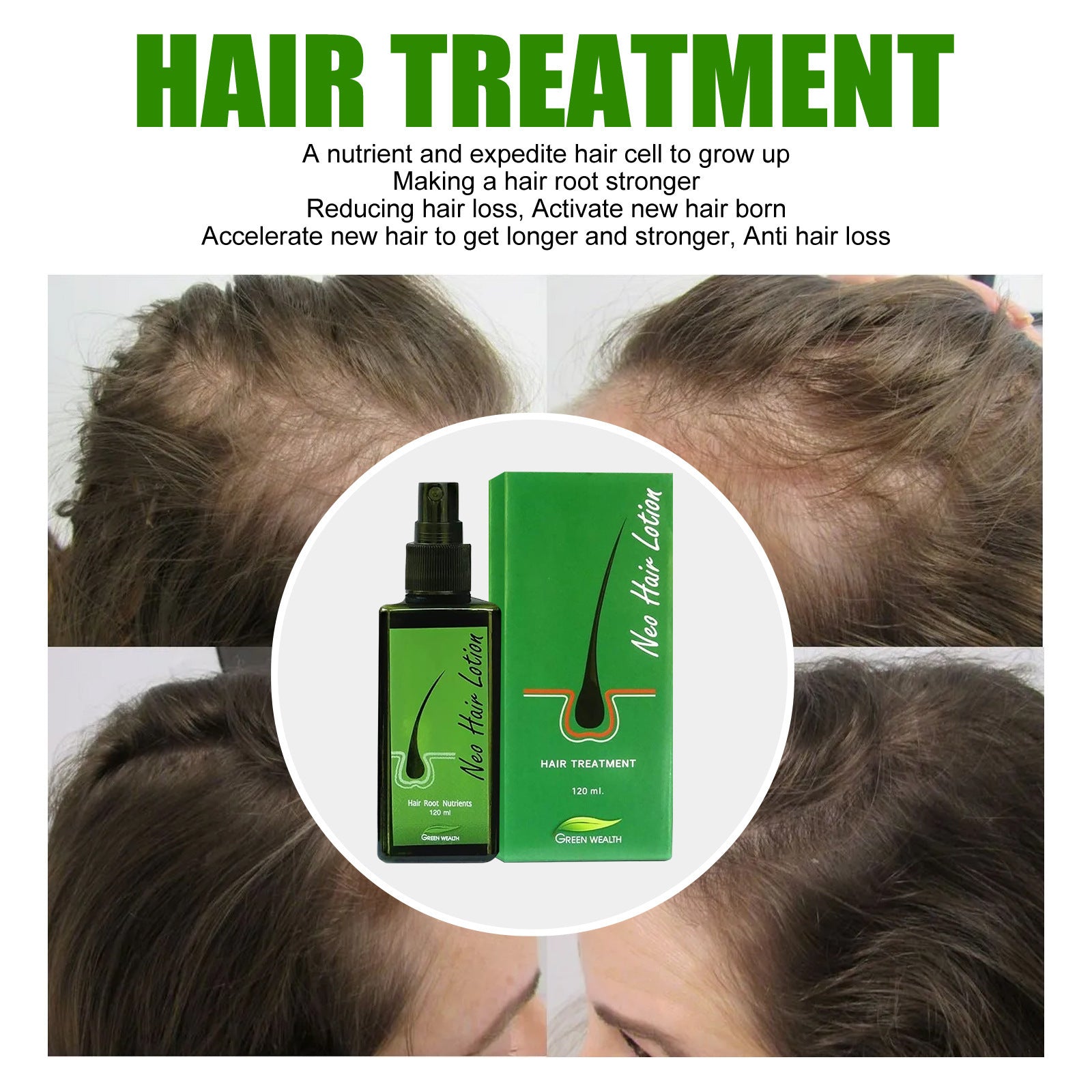 Neo Hair Lotion Serum Spray - Natural Anti-Hair Loss Formula, 120ml