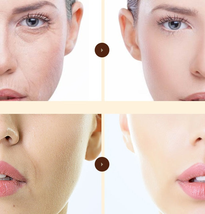 Soft Blue Gold Protein Peptide Set - Anti-Wrinkle & Firming Skincare Kit