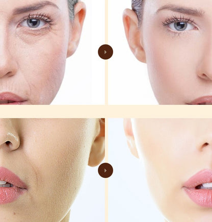 Soft Blue Gold Protein Peptide Set - Anti-Wrinkle & Firming Skincare Kit