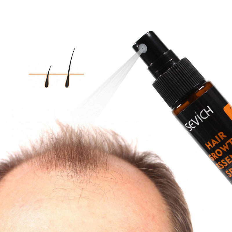 Anti-Drop Hair Lotion for Stronger Roots & Hair Growth – 30ml