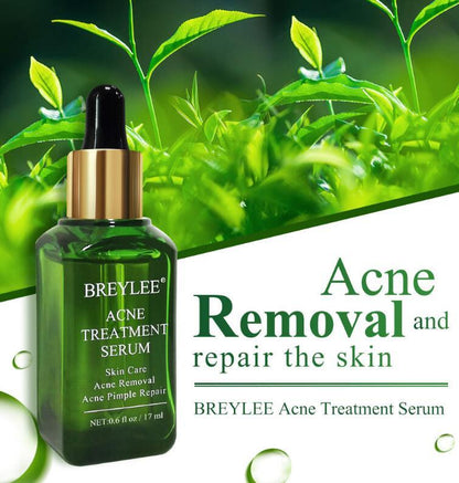 Advanced Acne Repair Serum with Camellia Sinensis & Plant Extracts