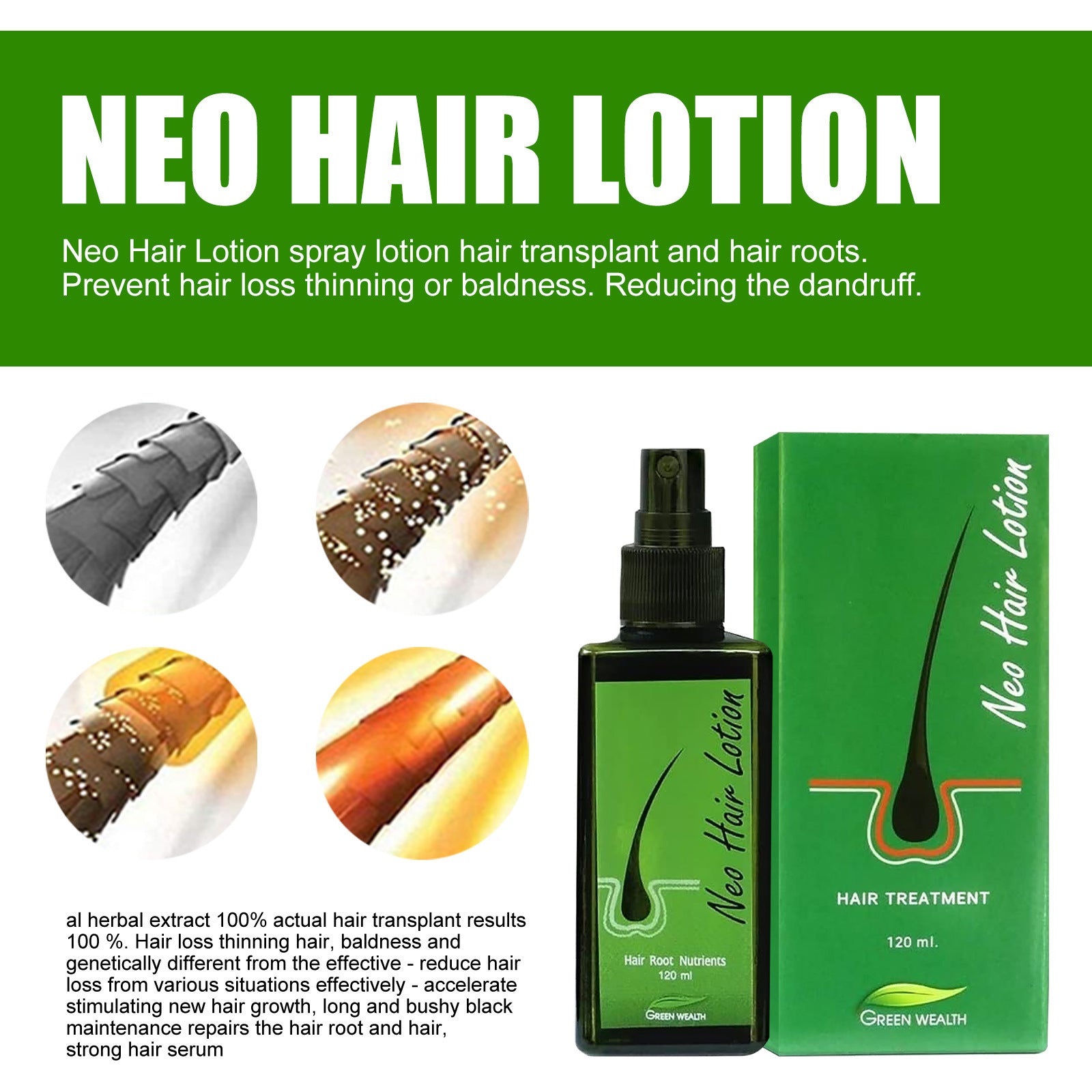 Neo Hair Lotion Serum Spray - Natural Anti-Hair Loss Formula, 120ml
