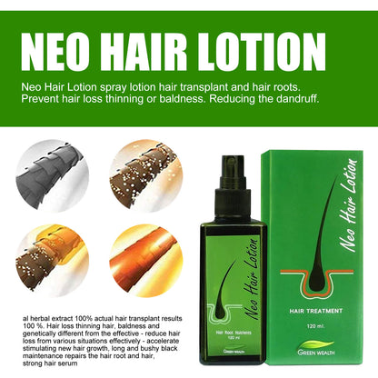 Neo Hair Lotion Serum Spray - Natural Anti-Hair Loss Formula, 120ml