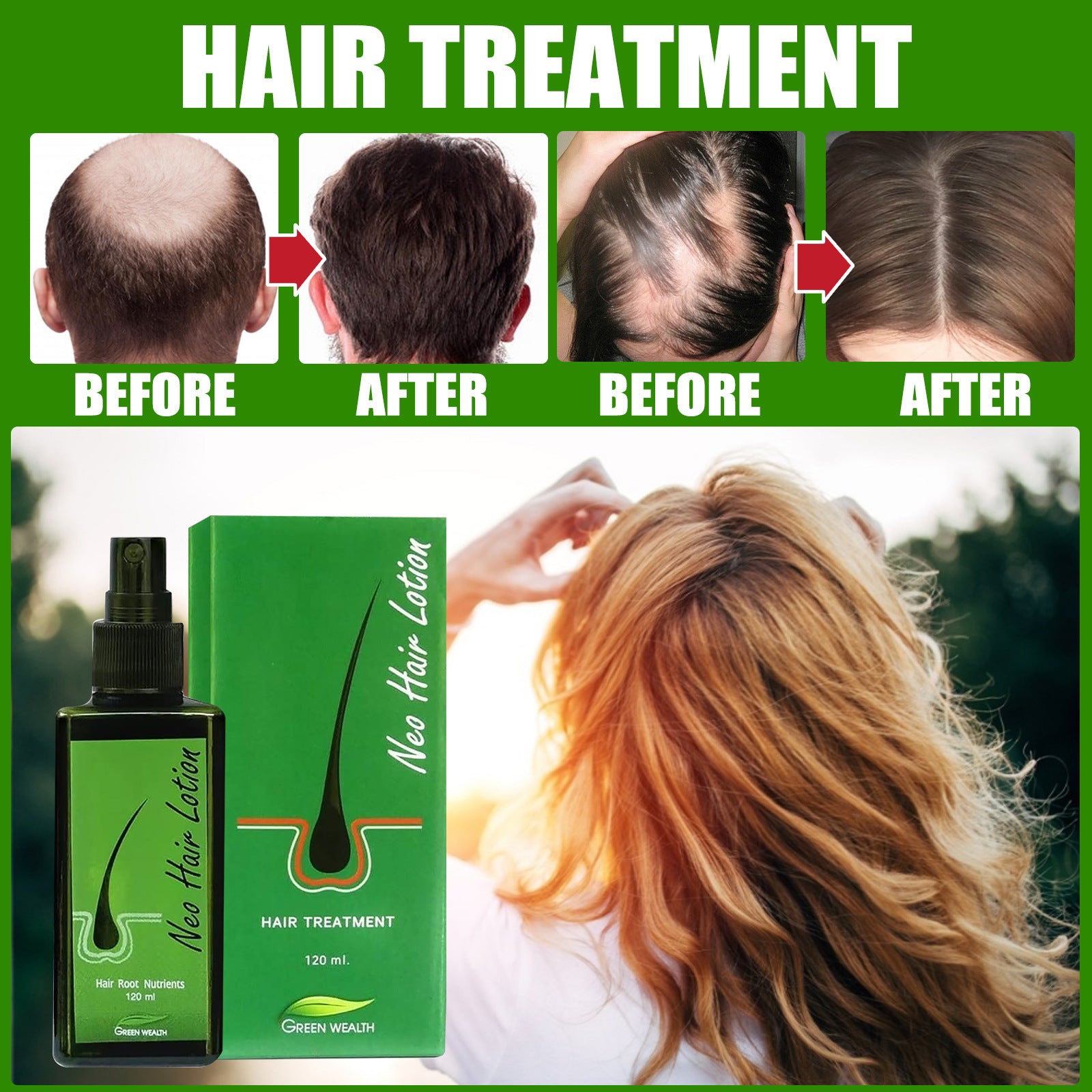 Neo Hair Lotion Serum Spray - Natural Anti-Hair Loss Formula, 120ml
