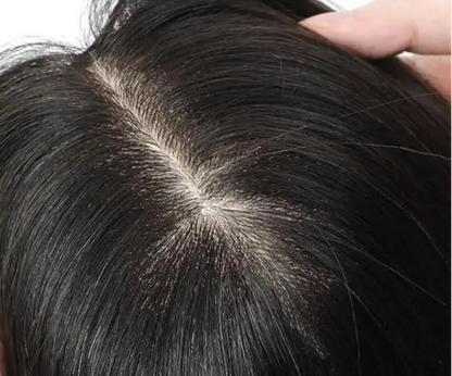 6mm Toupee for Men – Natural Hair Texture | 6-Month Durable Hairpiece